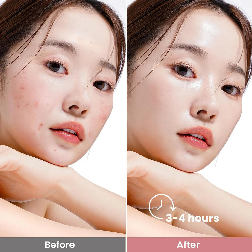 Skin Secret Bio-Collagen Real Deep Mask