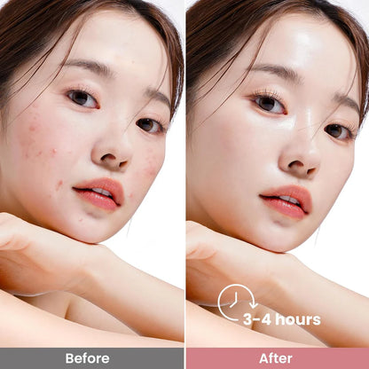 Skin Secret Bio-Collagen Real Deep Mask
